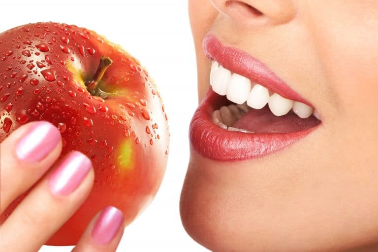 Estética dental: carillas dentales